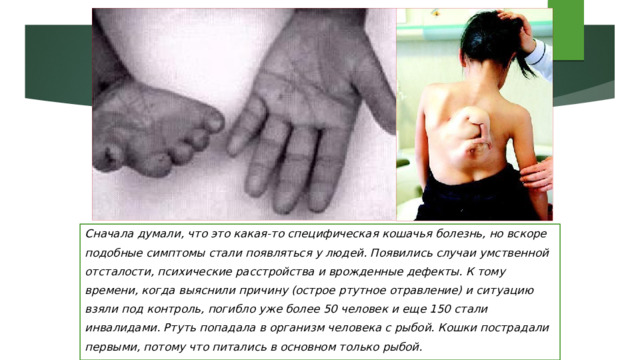 Сначала думали, что это какая-то специфическая кошачья болезнь, но вскоре подобные симптомы стали появляться у людей. Появились случаи умственной отсталости, психические расстройства и врожденные дефекты. К тому времени, когда выяснили причину (острое ртутное отравление) и ситуацию взяли под контроль, погибло уже более 50 человек и еще 150 стали инвалидами. Ртуть попадала в организм человека с рыбой. Кошки пострадали первыми, потому что питались в основном только рыбой. 