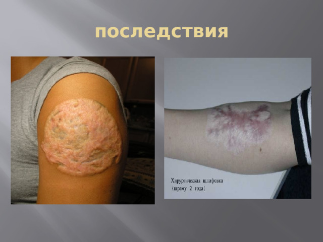 последствия 