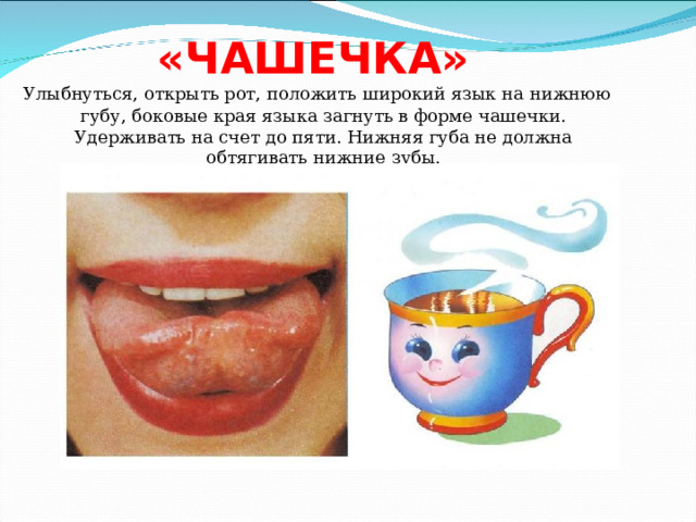 «ЧАШЕЧКА»  Улыбнуться, открыть рот, положить широкий язык на нижнюю губу, боковые края языка загнуть в форме чашечки. Удерживать на счет до пяти. Нижняя губа не должна обтягивать нижние зубы. 