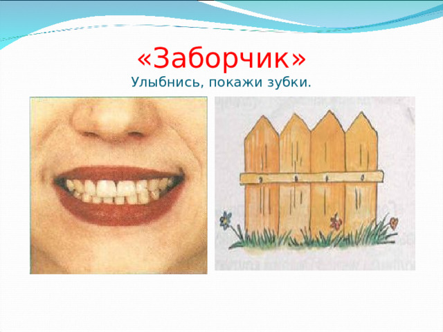 «Заборчик»  Улыбнись, покажи зубки. 