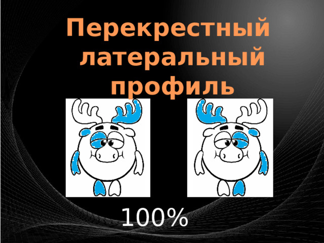 Перекрестный латеральный профиль 100% 