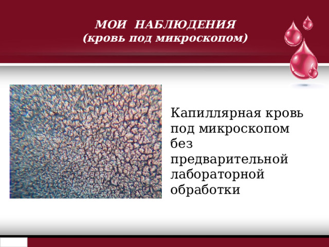 МОИ НАБЛЮДЕНИЯ  (кровь под микроскопом) Капиллярная кровь под микроскопом без предварительной лабораторной обработки 