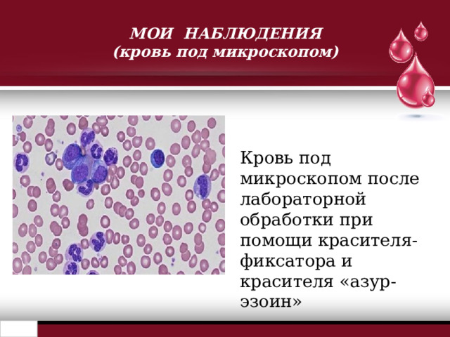 МОИ НАБЛЮДЕНИЯ  (кровь под микроскопом) Кровь под микроскопом после лабораторной обработки при помощи красителя-фиксатора и красителя «азур-эзоин» 