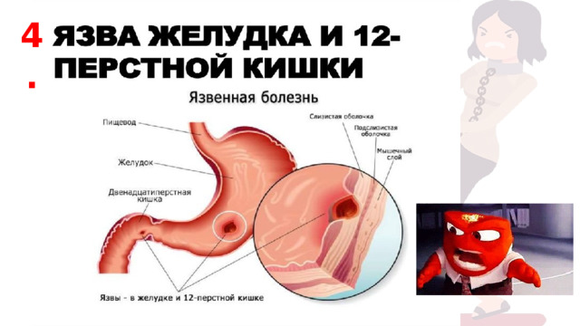 4. 