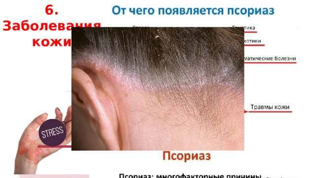 6. Заболевания кожи 