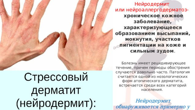 Нейродермит или нейроаллергодерматоз-   хроническое кожное заболевание, характеризующееся образованием высыпаний, мокнутия, участков пигментации на коже и сильным зудом .  Болезнь имеет рецидивирующее течение, причем периоды обострения случаются довольно часто. Патология считается одной из нозологических форм атопического дерматита, встречается среди всех категорий населения.  Нейродермит обнаруживается примерно у 1,5 % взрослых.  