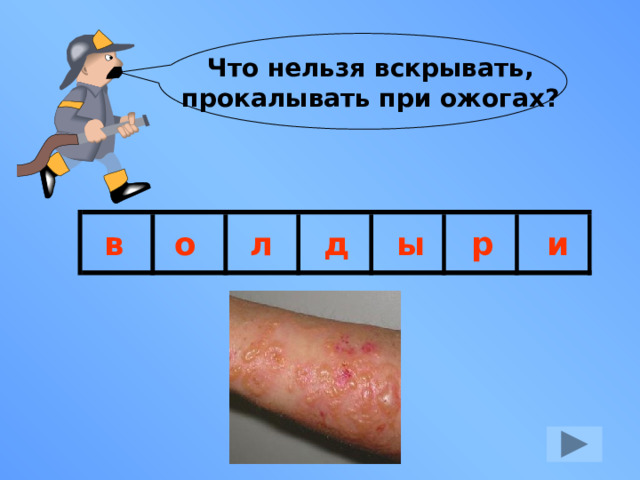 Что нельзя вскрывать,  прокалывать при ожогах? в о л д ы р и 