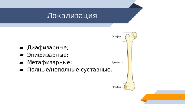 Локализация Диафизарные; Эпифизарные; Метафизарные; Полные/неполные суставные.  