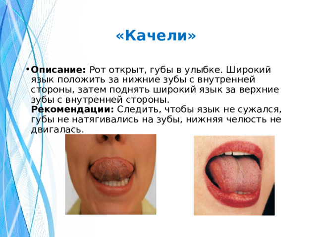 «Качели» Описание:  Рот открыт, губы в улыбке. Широкий язык положить за нижние зубы с внутренней стороны, затем поднять широкий язык за верхние зубы с внутренней стороны.  Рекомендации:  Следить, чтобы язык не сужался, губы не натягивались на зубы, нижняя челюсть не двигалась. 