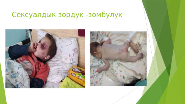 Сексуалдык зордук -зомбулук 