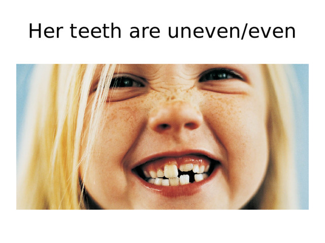 Her teeth are uneven/even 