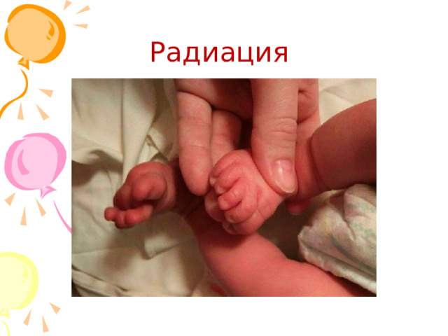 Радиация 