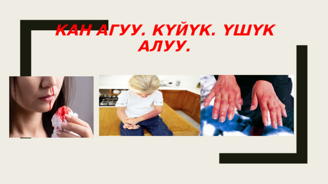 Кан агуу. Күйүк. Үшүк алуу. 
