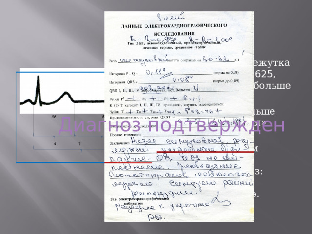 Отношение промежутка времени td к t =0 , 625 , что значительно больше значения 0,618. td : ts = 1,875 больше «золотого сечения» 1,618 Поэтому в данном примере можно поставить диагноз: брадикардия в умеренной форме. Диагноз подтвержден 