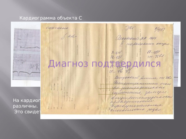 Кардиограмма объекта С Диагноз подтвердился На кардиограмме даже на глаз видно, что периоды синусоиды различны.  Это свидетельствует об изменениях формы сердца. 