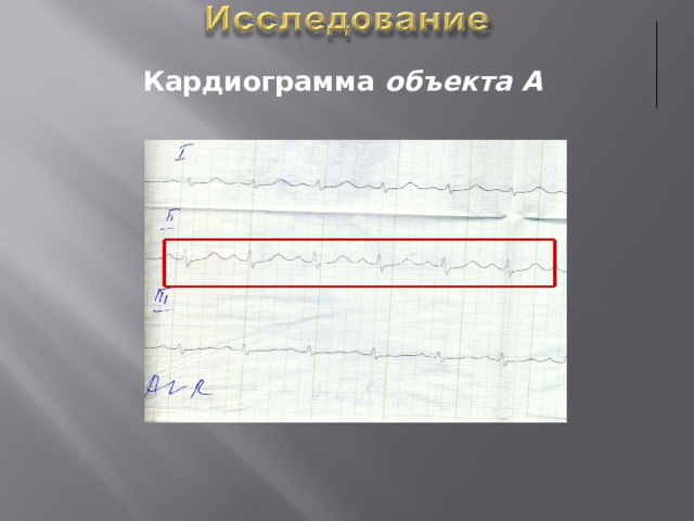 Кардиограмма объекта А   