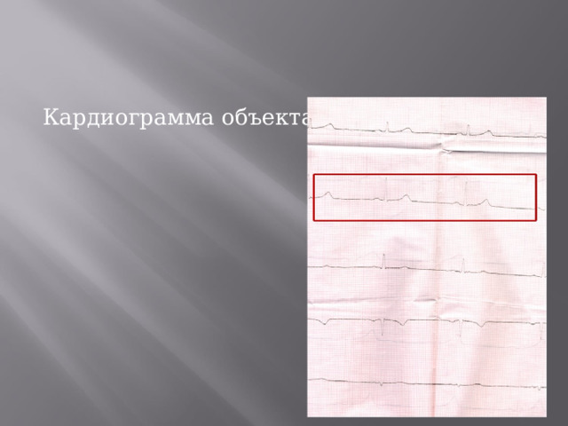 Кардиограмма объекта В 