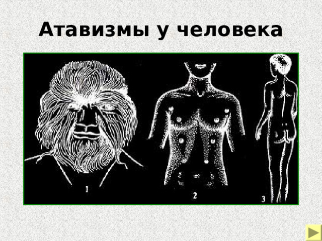 Атавизмы у человека Примеры морфологических доказательств эволюции. Атавизмы у человека – густой волосяной покров на лице и теле, развитие дополнительных пар млечных желез, хвостовой придаток.  