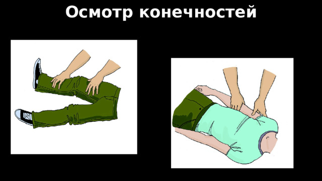 Осмотр конечностей 
