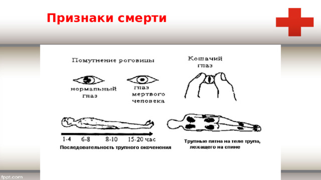 Признаки смерти 