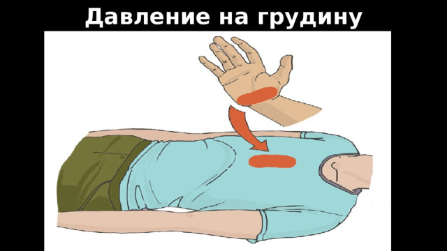 Давление на грудину 