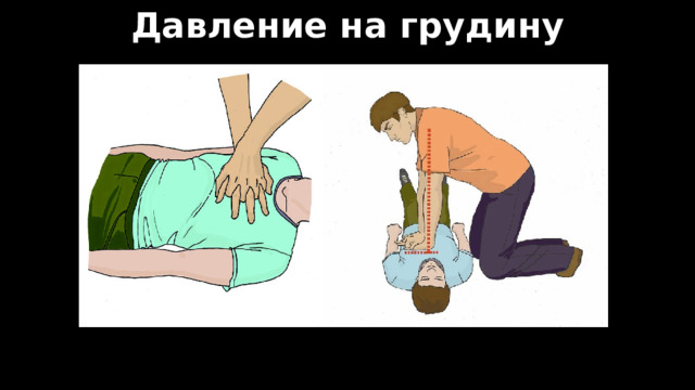Давление на грудину 