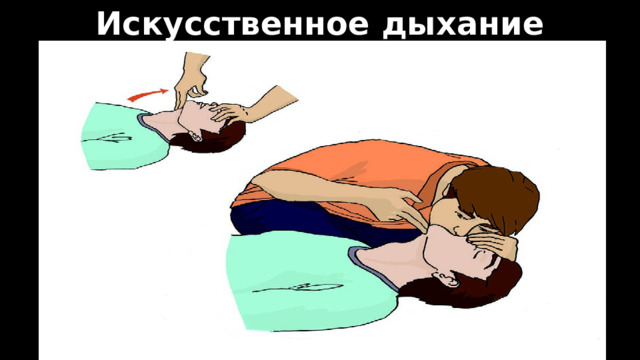 Искусственное дыхание 