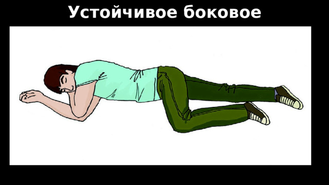 Устойчивое боковое положение 
