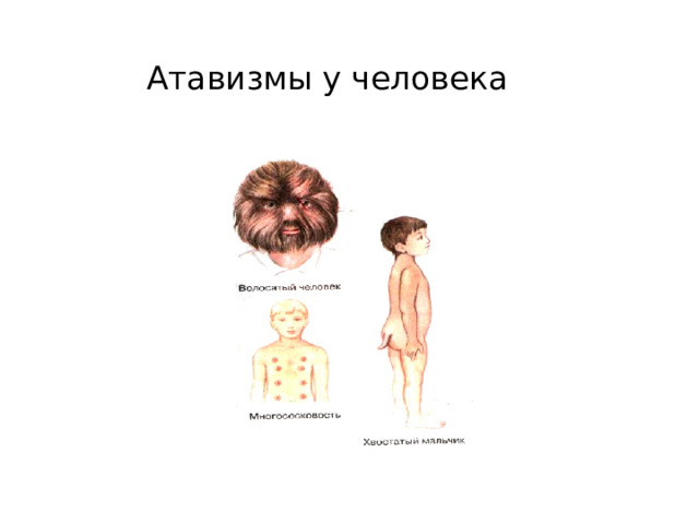  Атавизмы у человека 