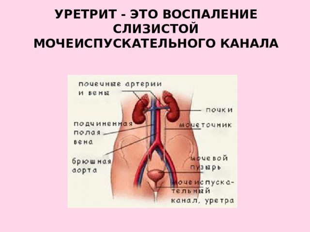 УРЕТРИТ - это воспаление слизистой мочеиспускательного канала 