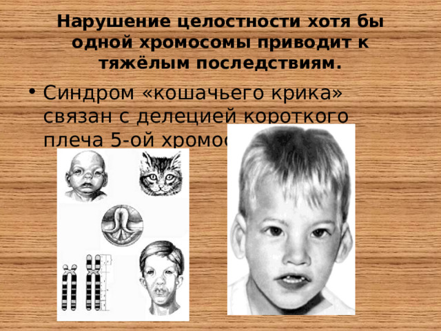 Нарушение целостности хотя бы одной хромосомы приводит к тяжёлым последствиям. Синдром «кошачьего крика» связан с делецией короткого плеча 5-ой хромосомы. 