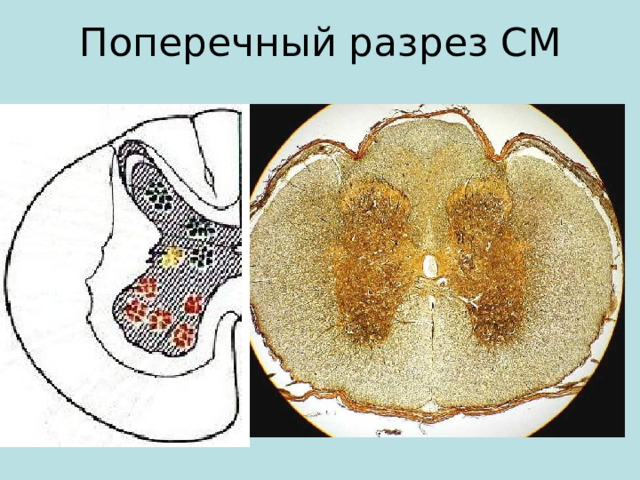 Поперечный разрез СМ 