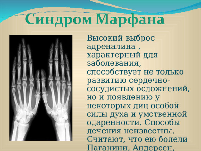 Высокий выброс адреналина , характерный для заболевания, способствует не только развитию сердечно-сосудистых осложнений, но и появлению у некоторых лиц особой силы духа и умственной одаренности. Способы лечения неизвестны. Считают, что ею болели Паганини, Андерсен, Чуковский. 