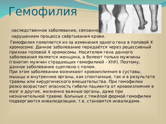 Гемофилия  наследственное заболевание, связанное с  нарушением процесса свёртывания крови.  Гемофилия появляется из-за изменения одного гена в половой Х хромосоме. Данное заболевание передаётся через рецессивный признак половой Х хромосомы. Носителем гена данного заболевания является женщина, а болеют только мужчины (генотип мужчин страдающих гемофилией - ХhУ). Поэтому, данное заболевание сцеплено с полом.  При этом заболевании возникают кровоизлияния в суставы, мышцы и внутренние органы, как спонтанные, так и в результате травмы или хирургического вмешательства. При гемофилии резко возрастает опасность гибели пациента от кровоизлияния в мозг и другие, жизненно важные органы, даже при незначительной травме. Больные с тяжёлой формой гемофилии подвергаются инвалидизации, т.е. становятся инвалидами.   