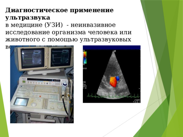 Диагностическое применение ультразвука  в медицине (УЗИ) - неинвазивное исследование организма человека или животного с помощью ультразвуковых волн. 