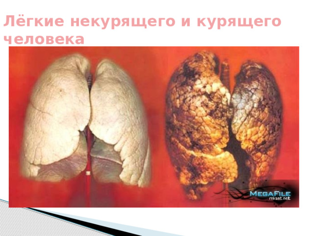 Лёгкие некурящего и курящего человека 