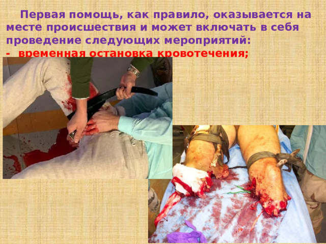  Первая помощь, как правило, оказывается на месте происшествия и может включать в себя проведение следующих мероприятий: - временная остановка кровотечения; 