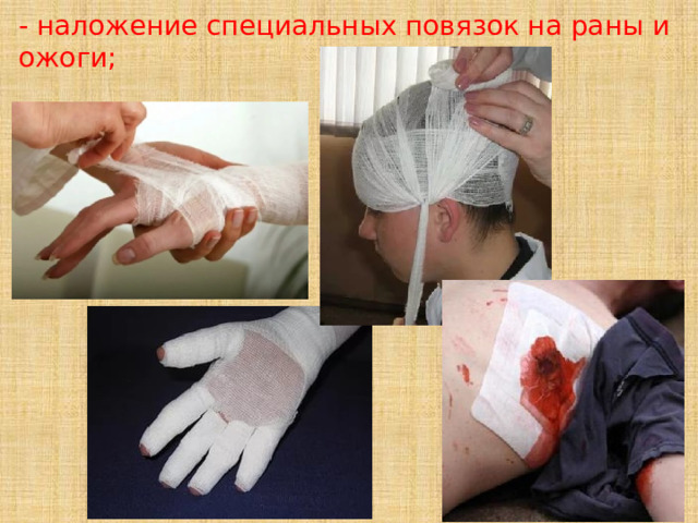 - наложение специальных повязок на раны и ожоги; 