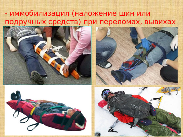 - иммобилизация (наложение шин или подручных средств) при переломах, вывихах и ушибах; 