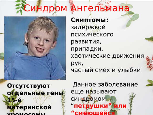 Синдром Ангельмана Симптомы: задержкой психического развития, припадки, хаотические движения рук, частый смех и улыбки  Данное заболевание еще называют синдромом “ петрушки” или “смеющейся куклы”. Отсутствуют отдельные гены 15-й материнской хромосомы. 