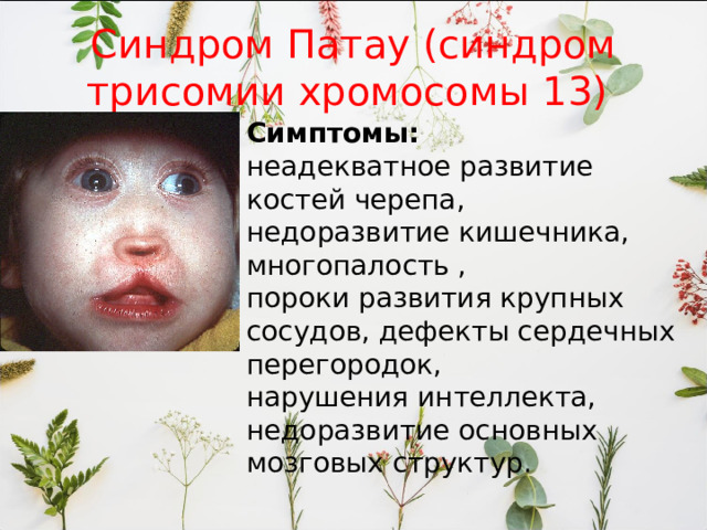 Синдром Патау (синдром трисомии хромосомы 13) Симптомы: неадекватное развитие костей черепа, недоразвитие кишечника, многопалость , пороки развития крупных сосудов, дефекты сердечных перегородок, нарушения интеллекта, недоразвитие основных мозговых структур. 