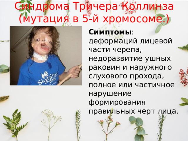 Синдрома Тричера Коллинза (мутация в 5-й хромосоме.) Симптомы : деформаций лицевой части черепа, недоразвитие ушных раковин и наружного слухового прохода, полное или частичное нарушение формирования правильных черт лица. 