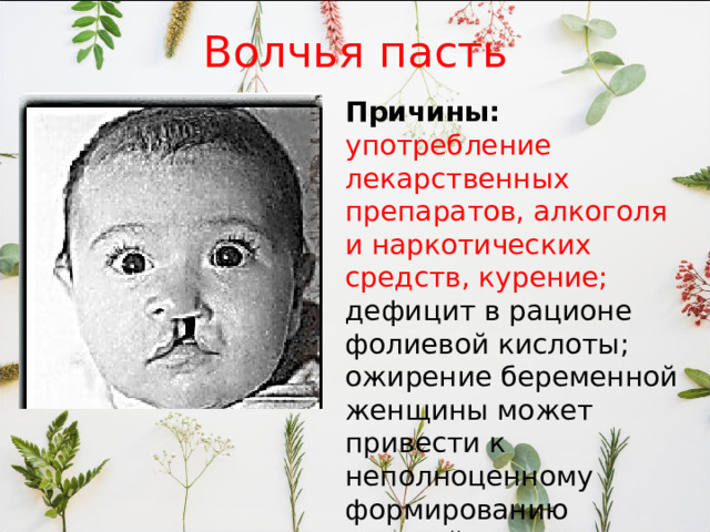 Волчья пасть Причины: употребление лекарственных препаратов, алкоголя и наркотических средств, курение; дефицит в рационе фолиевой кислоты; ожирение беременной женщины может привести к неполноценному формированию верхней челюсти плода. 