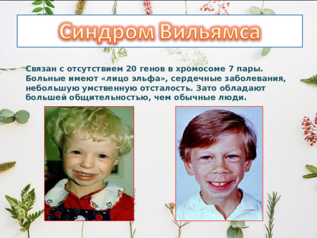 Связан с отсутствием 20 генов в хромосоме 7 пары. Больные имеют «лицо эльфа», сердечные заболевания, небольшую умственную отсталость. Зато обладают большей общительностью, чем обычные люди. 