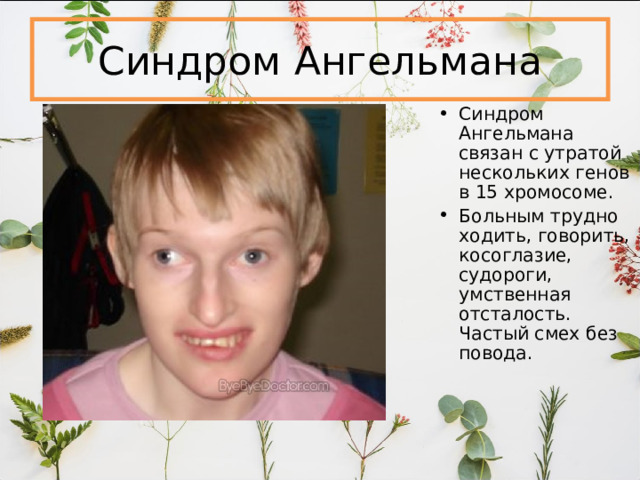 Синдром Ангельмана Синдром Ангельмана связан с утратой нескольких генов в 15 хромосоме. Больным трудно ходить, говорить, косоглазие, судороги, умственная отсталость. Частый смех без повода. 