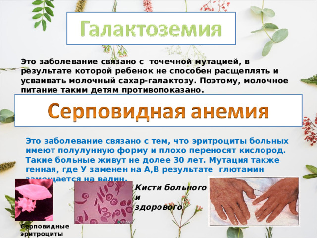 Это заболевание связано с точечной мутацией, в результате которой ребенок не способен расщеплять и усваивать молочный сахар-галактозу. Поэтому, молочное питание таким детям противопоказано. Это заболевание связано с тем, что эритроциты больных имеют полулунную форму и плохо переносят кислород. Такие больные живут не долее 30 лет. Мутация также генная, где У заменен на А,В результате глютамин замещается на валин. Кисти больного и здорового Серповидные эритроциты 