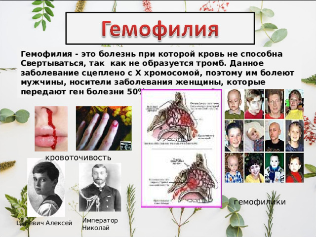 Гемофилия - это болезнь при которой кровь не способна Свертываться, так как не образуется тромб. Данное заболевание сцеплено с Х хромосомой, поэтому им болеют мужчины, носители заболевания женщины, которые передают ген болезни 50% своих сыновей.  кровоточивость гемофилики Император Николай Царевич Алексей 