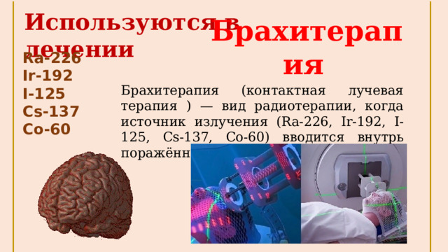 Используются в лечении Брахитерапия  Ra-226 Ir-192 I-125 Cs-137 Co-60 Брахитерапия (контактная лучевая терапия ) — вид радиотерапии, когда источник излучения (Ra-226, Ir-192, I-125, Cs-137, Co-60) вводится внутрь поражённого органа. 