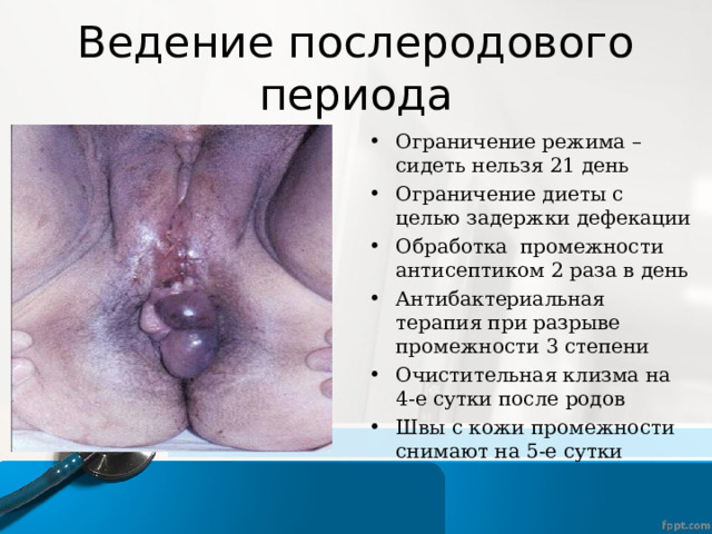 Ведение послеродового периода Ограничение режима – сидеть нельзя 21 день Ограничение диеты с целью задержки дефекации Обработка промежности антисептиком 2 раза в день Антибактериальная терапия при разрыве промежности 3 степени Очистительная клизма на 4-е сутки после родов Швы с кожи промежности снимают на 5-е сутки 