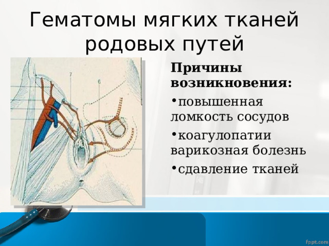 Гематомы мягких тканей родовых путей Причины возникновения: повышенная ломкость сосудов коагулопатии варикозная болезнь сдавление тканей 